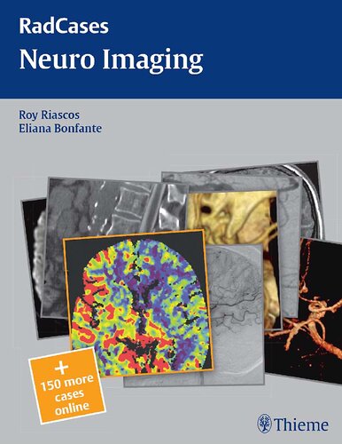 Radcases Neuro Imaging (Radcases Plus Q&A)