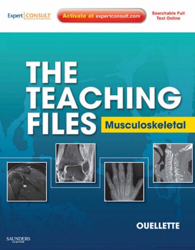 The Teaching Files: Musculoskeletal: Expert Consult - Online and Print (Teaching Files in Radiology)