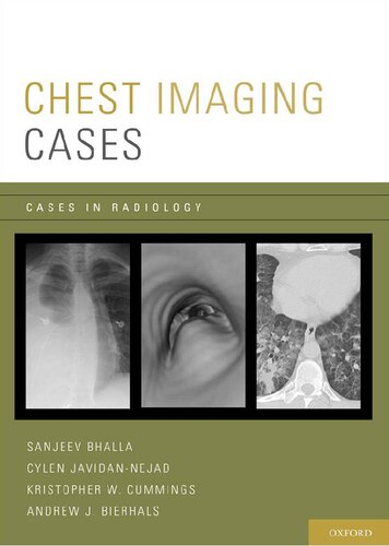 Chest Imaging Cases (Cases in Radiology)