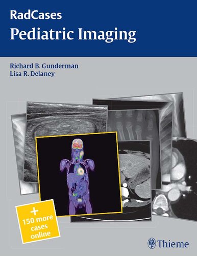 Pediatric Imaging (RadCases)