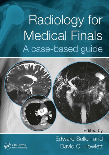 Radiology for Medical Finals: A case-based guide