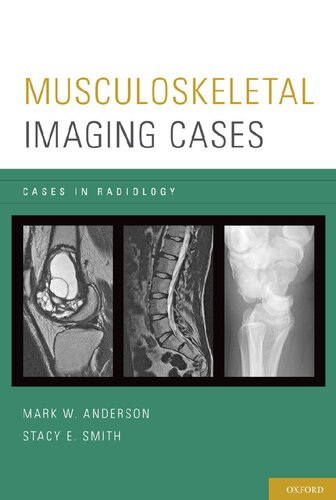 Musculoskeletal Imaging Cases (Cases in Radiology)