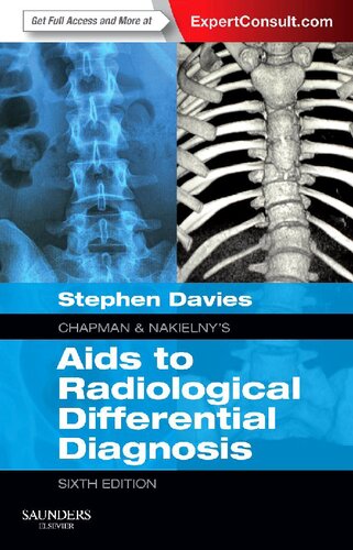 Chapman & Nakielny's Aids to Radiological Differential Diagnosis: Expert Consult - Online and Print