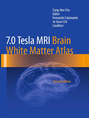 7.0 Tesla MRI Brain White Matter Atlas