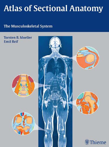 Atlas of Sectional Anatomy: The Musculoskeletal System