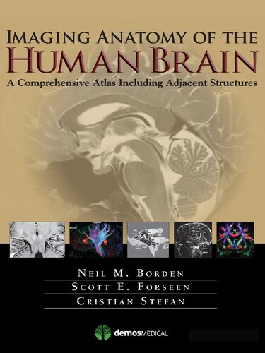 Imaging Anatomy of the Human Brain: A Comprehensive Atlas Including Adjacent Structures