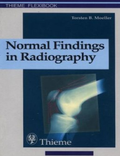 Normal Findings in Radiography