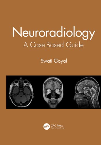 Neuroradiology: A Case-Based Guide