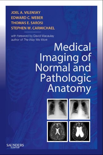 Medical Imaging of Normal and Pathologic Anatomy, 1e
