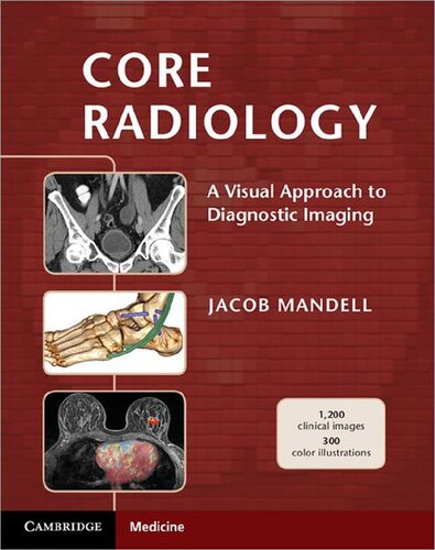 Core Radiology: A Visual Approach to Diagnostic Imaging