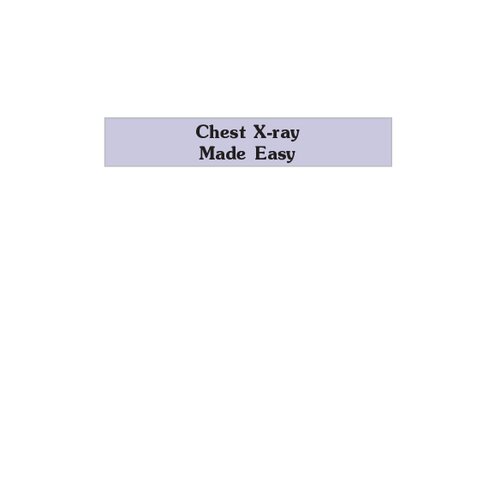 Chest X-ray Made Easy