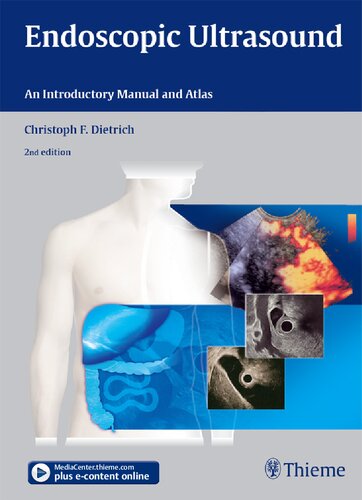 Endoscopic Ultrasound: An Introductory Manual and Atlas