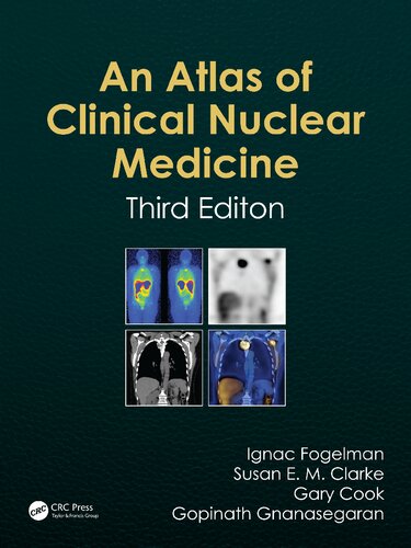 Atlas of Clinical Nuclear Medicine
