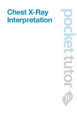 Pocket Tutor Chest X-Ray Interpretation