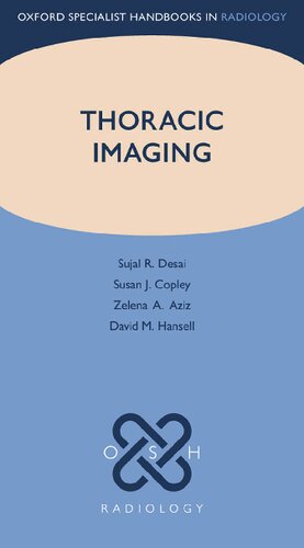 Thoracic Imaging (Oxford Specialist Handbooks in Radiology)