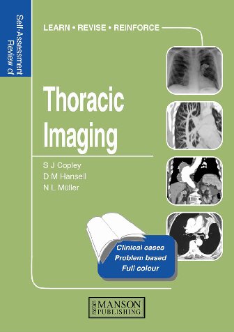 Self-assessment Colour Review of Thoracic Imaging