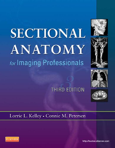 Sectional Anatomy for Imaging Professionals, 3e