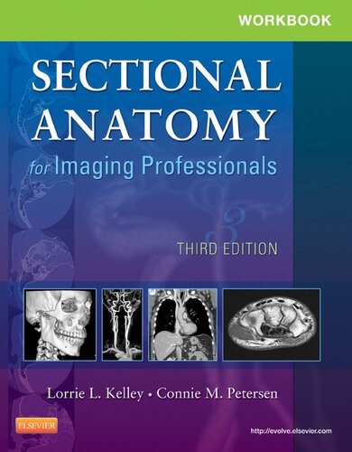 Workbook for Sectional Anatomy for Imaging Professionals