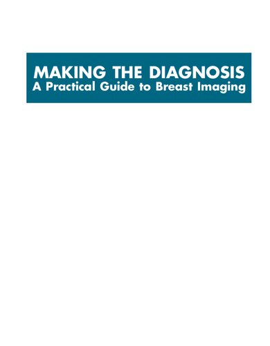 Making the Diagnosis: A Practical Guide to Breast Imaging: Expert Consult - Online and Print