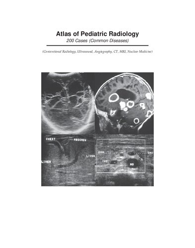 Atlas of Pediatric Radiology