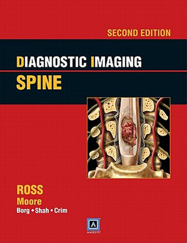 Diagnostic Imaging: Spine