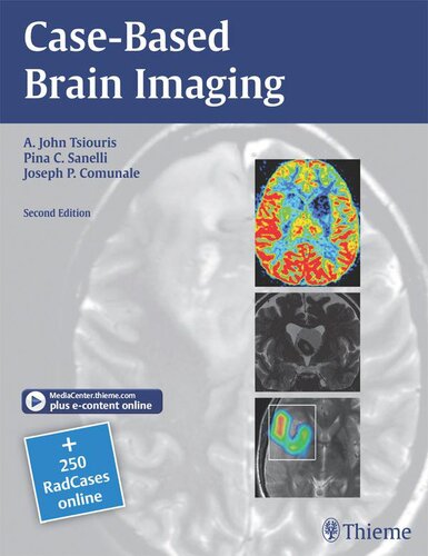 Case-Based Brain Imaging (RadCases)