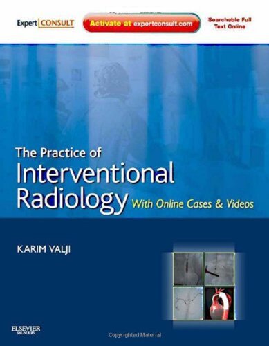 The Practice of Interventional Radiology, with online cases and video: Expert Consult Premium Edition - Enhanced Online Features and Print, 1e (Expert Consult Title: Online + Print)