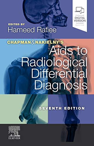 Chapman & Nakielny's Aids to Radiological Differential Diagnosis: Expert Consult - Online and Print