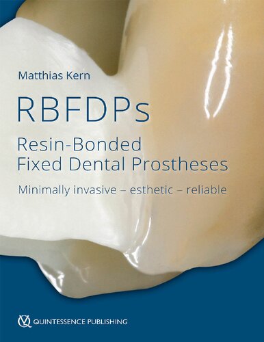 RBFDPs : resin-bonded fixed dental prostheses : minimally invasive, esthetic, reliable