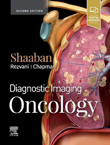 Diagnostic Imaging: Oncology, 2e (2020)