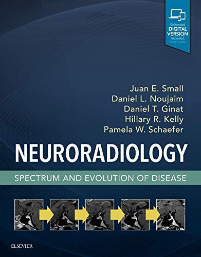 Neuroradiology: Spectrum and Evolution of Disease