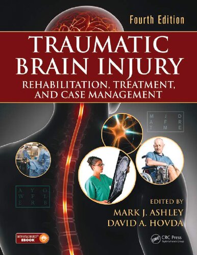 Traumatic Brain Injury_ Rehabilitation, Treatment, and Case Management, Fourth Edition-CRC Press (2018)