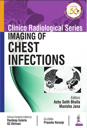 Clinico Radiological Series: Imaging of Chest Infections