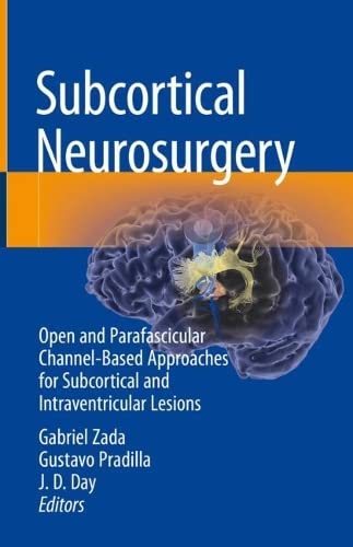 Subcortical Neurosurgery: Open and Parafascicular Channel-Based Approaches for Subcortical and Intraventricular Lesions