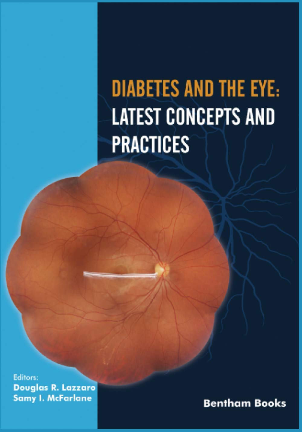 Diabetes and the Eye: Latest Concepts and Practices