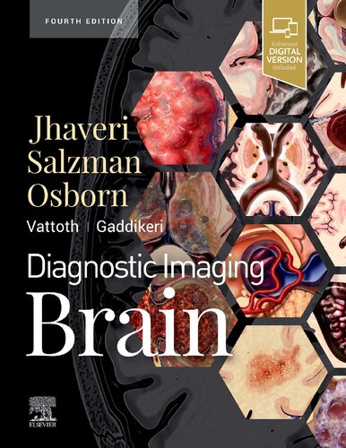 Diagnostic Imaging: Brain