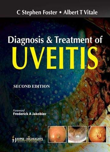 Diagnosis and Treatment of Uveitis