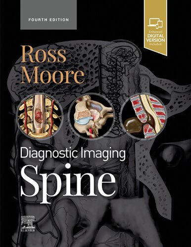 Diagnostic Imaging: Spine