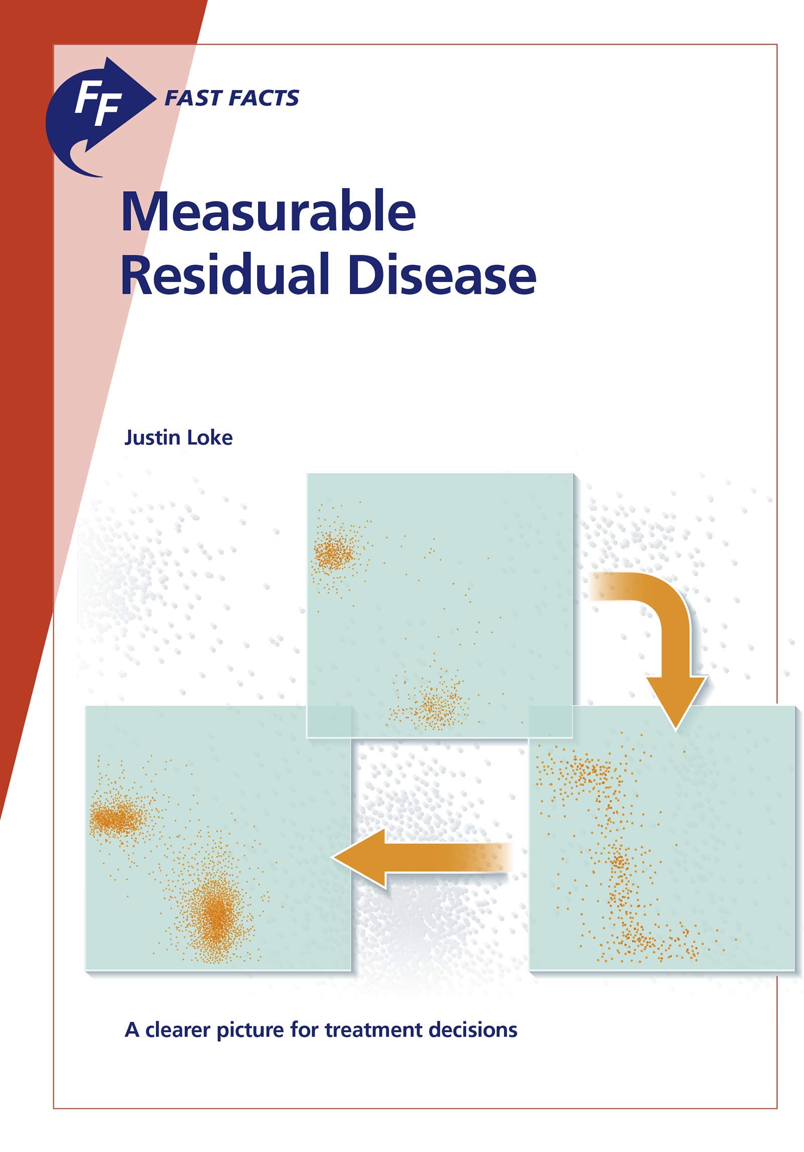 Measurable Residual Disease: A clearer picture for treatment decisions