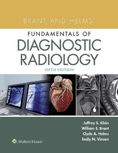 Fundamentals of Diagnostic Radiology all 4 volumes - Brant Helms - 5th Edition