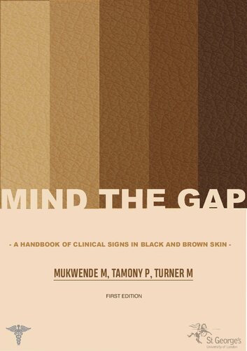 Mind the Gap: A handbook of clinical signs in Black and Brown skin