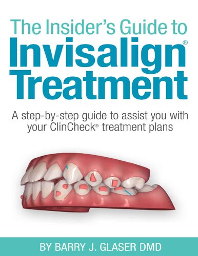 The Insider's Guide to Invisalign Treatment: A step-by-step guide to assist your ClinCheck treatment plan