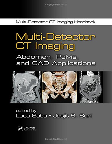 Multi-Detector CT Imaging Handbook, Two Volume Set