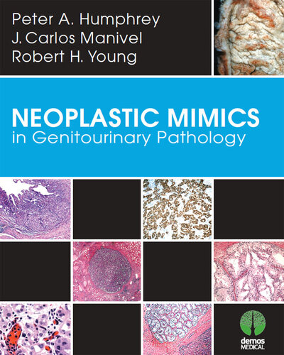 Neoplastic Mimics in Genitourinary Pathology