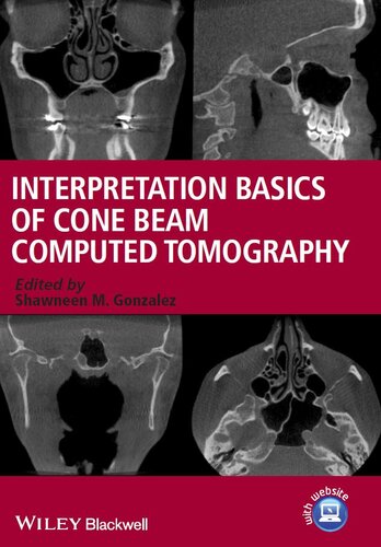 Interpretation Basics of Cone Beam Computed Tomography
