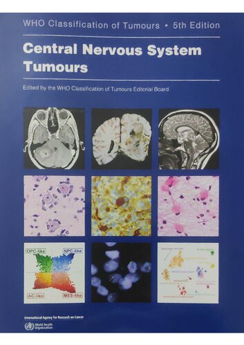 Who Classification of Tumours - Central Nervous System Tumours