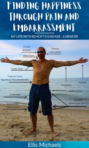 Finding Happiness Through Pain and Embarrassment: My Life With Behcet's Disease--A Memoir