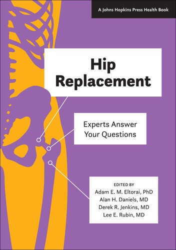 Hip Replacement: Experts Answer Your Questions