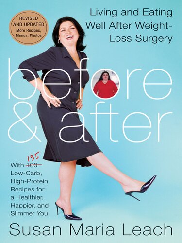 Before & After, Revised Edition: Living & Eating Well After Weight Loss Surgery