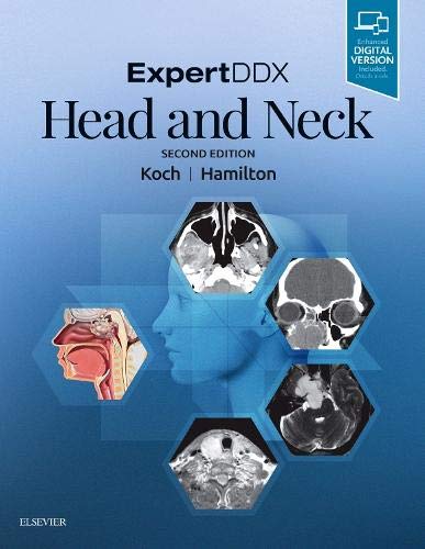 ExpertDDX: Head and Neck, 2e